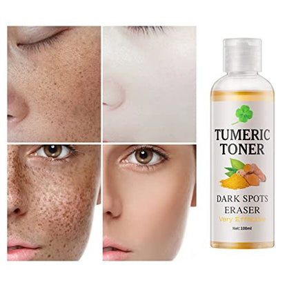 YAFUSIPE Turmeric Dark Spot Corrector Toner – Hydrating Facial Toner for Acne Prone Skin, Dark Spot Correcting Face Toner for All Skin Types, 3.4 oz Avelisse