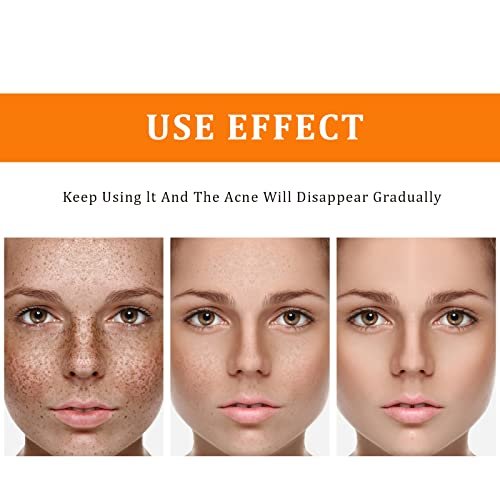 YAFUSIPE Turmeric Dark Spot Corrector Toner – Hydrating Facial Toner for Acne Prone Skin, Dark Spot Correcting Face Toner for All Skin Types, 3.4 oz Avelisse
