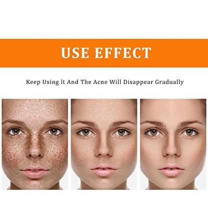 YAFUSIPE Turmeric Dark Spot Corrector Toner – Hydrating Facial Toner for Acne Prone Skin, Dark Spot Correcting Face Toner for All Skin Types, 3.4 oz Avelisse