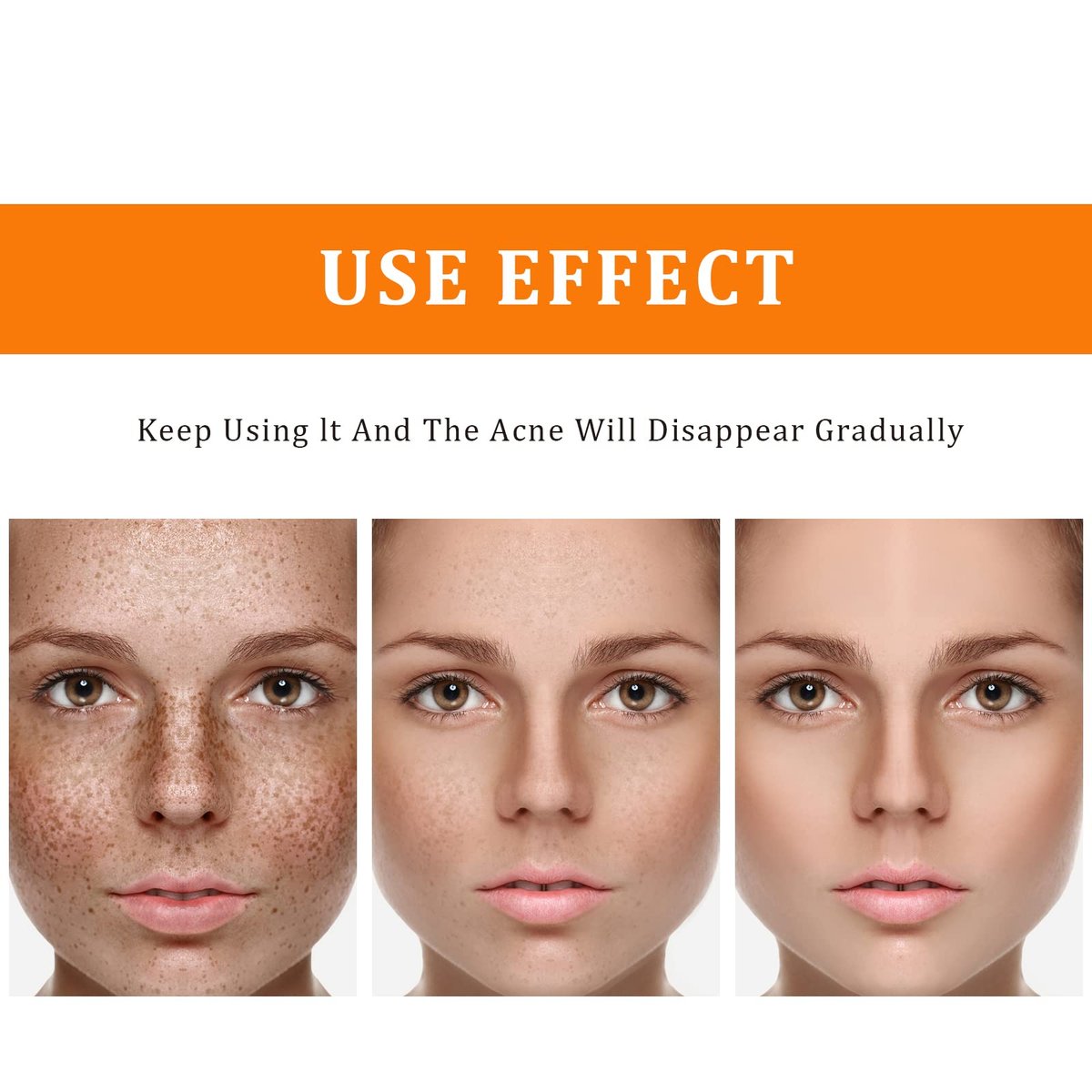 YAFUSIPE Turmeric Dark Spot Corrector Toner – Hydrating Facial Toner for Acne Prone Skin, Dark Spot Correcting Face Toner for All Skin Types, 3.4 oz Avelisse
