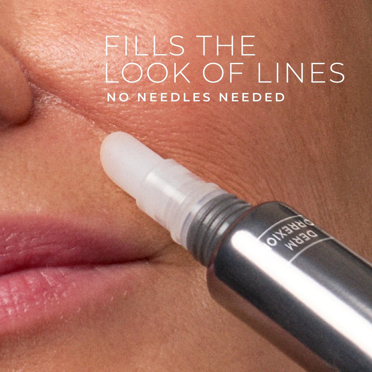 RoC Derm Correxion Fill + Treat Advanced Retinol Serum with Hyaluronic Acid for Crow's Feet, 11 Wrinkles & Laugh Lines, 0.5 fl oz Avelisse