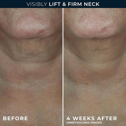 RoC Derm Correxion Neck Cream with Hyaluronic Acid + Advanced Retinol - Visibly Tighten & Lift Horizontal Neck Lines, 1.7 oz Avelisse
