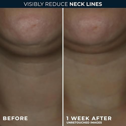 RoC Derm Correxion Neck Cream with Hyaluronic Acid + Advanced Retinol - Visibly Tighten & Lift Horizontal Neck Lines, 1.7 oz Avelisse