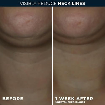 RoC Derm Correxion Neck Cream with Hyaluronic Acid + Advanced Retinol - Visibly Tighten & Lift Horizontal Neck Lines, 1.7 oz Avelisse