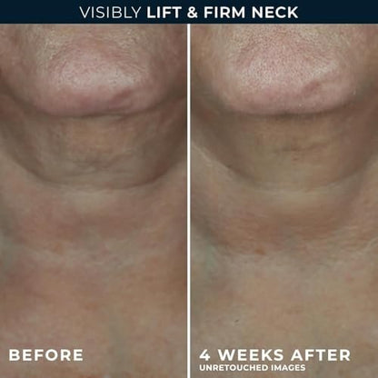 RoC Derm Correxion Neck Cream with Hyaluronic Acid + Advanced Retinol - Visibly Tighten & Lift Horizontal Neck Lines, 1.7 oz Avelisse