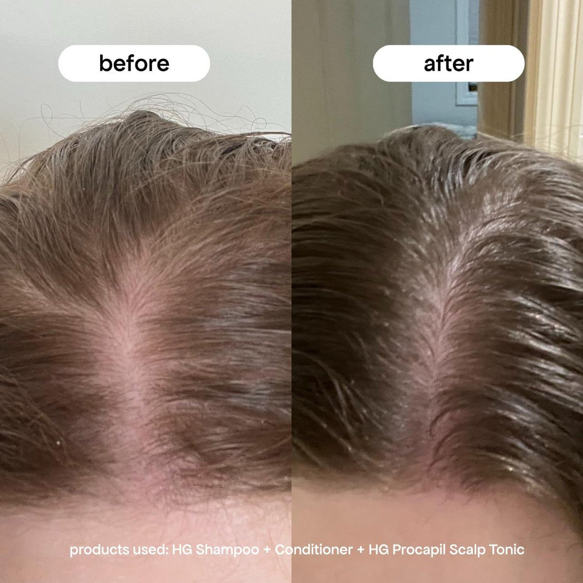 BONDIBOOST Procapil Scalp Treatment – Daily Leave-In Serum for Thicker, Fuller Hair with Procapil, Rosemary & Biotinoyl Tripeptide-1, Sulfate-Free, 4.23 fl oz - görsel 5