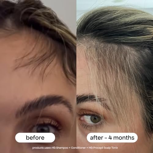 BONDIBOOST Procapil Scalp Treatment – Daily Leave-In Serum for Thicker, Fuller Hair with Procapil, Rosemary & Biotinoyl Tripeptide-1, Sulfate-Free, 4.23 fl oz - görsel 6