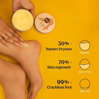 Vilvah Foot Cream for Dry and Cracked Feet | Moisturizes Rough Heels, Softens Chapped & Calloused Skin – Suitable for All Skin Types, 100ml