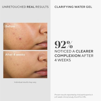 Murad Clarifying Water Gel – Lightweight Face Moisturizer for Acne-Prone Skin with Salicylic and Hyaluronic Acid, 2 Fl Oz Avelisse