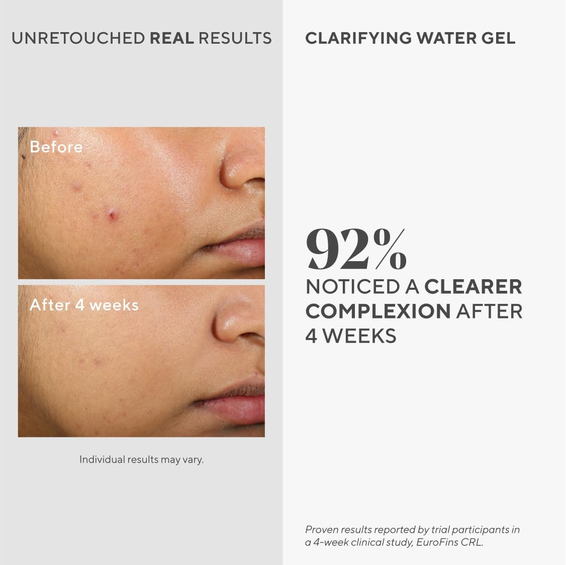 Murad Clarifying Water Gel – Lightweight Face Moisturizer for Acne-Prone Skin with Salicylic and Hyaluronic Acid, 2 Fl Oz Avelisse