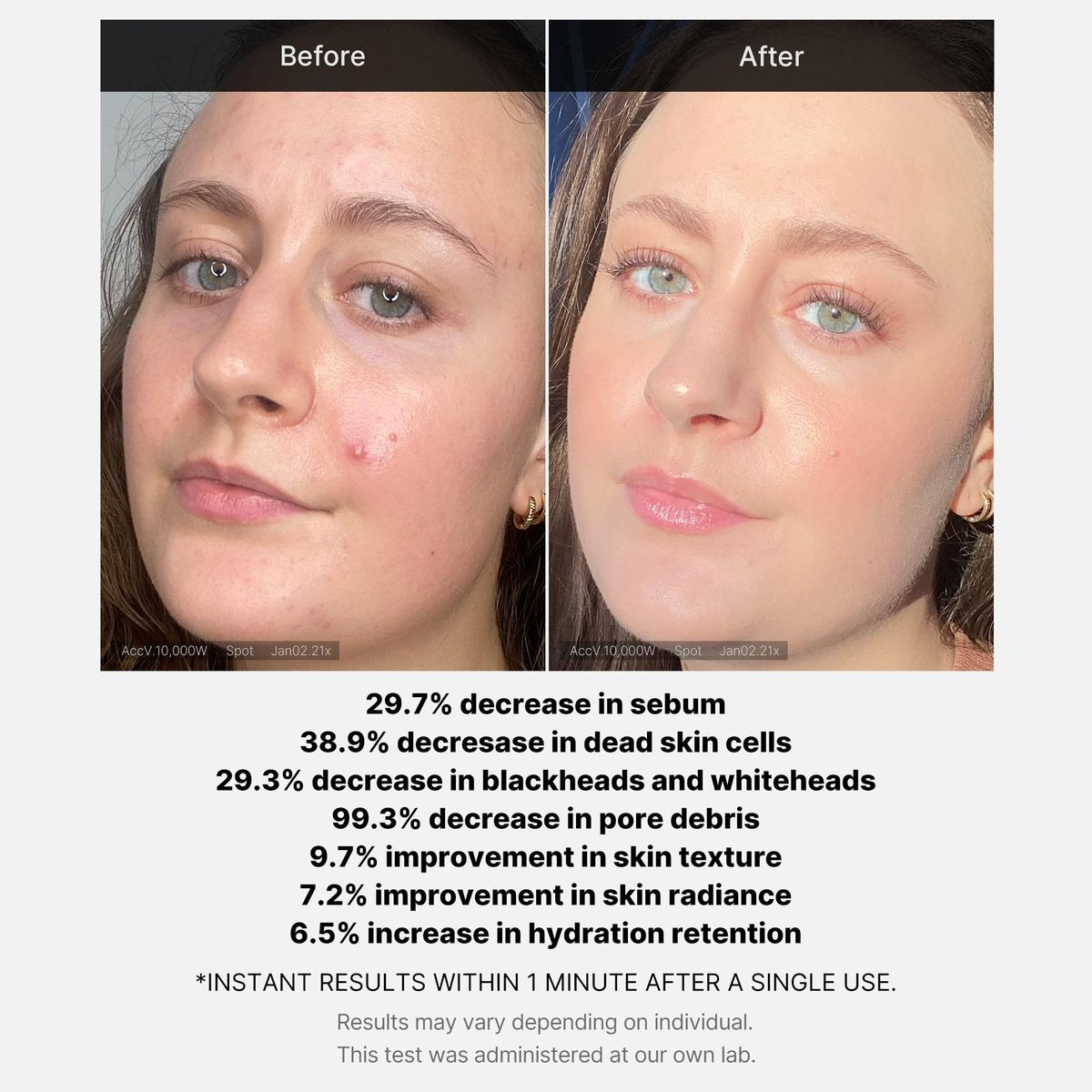 Medicube 21% Acid Wash-off Exfoliant – AHA + BHA + Succinic Acid Resurfacing Serum for Bumpy, Breakout-Prone Skin | Korean Skincare (1.41 fl oz) - görsel 8