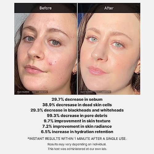 Medicube 21% Acid Wash-off Exfoliant – AHA + BHA + Succinic Acid Resurfacing Serum for Bumpy, Breakout-Prone Skin | Korean Skincare (1.41 fl oz) - görsel 7