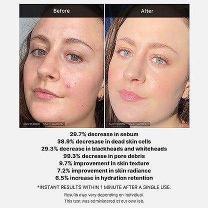 Medicube 21% Acid Wash-off Exfoliant – AHA + BHA + Succinic Acid Resurfacing Serum for Bumpy, Breakout-Prone Skin | Korean Skincare (1.41 fl oz)