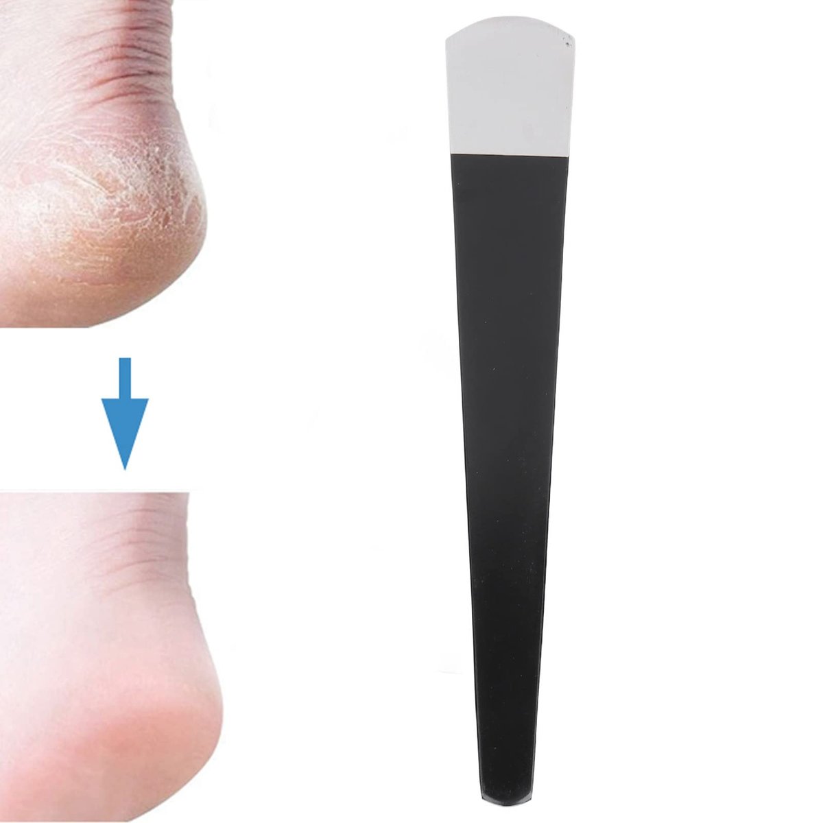 Professional Pedicure Scraping Knife – Stainless Steel Callus Remover for Cracked Heels & Hard Skin Avelisse
