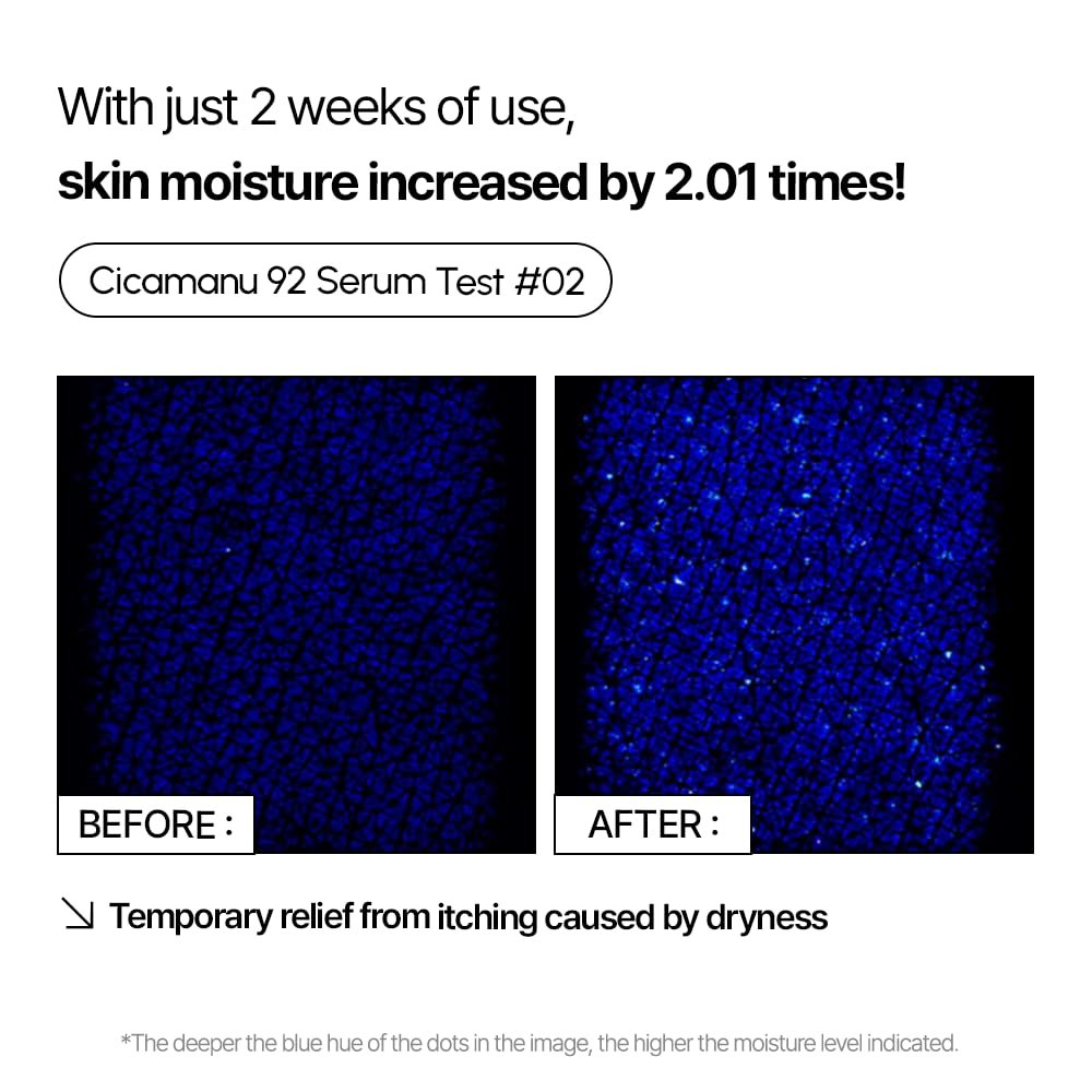 Parnell Cicamanu 92 Serum – Overnight Recovery & Deep Hydration with Melatonin, Centella Asiatica & Ceramide for Hyperpigmentation, 1.01 Fl Oz (30ml) Korean Skin Care Avelisse
