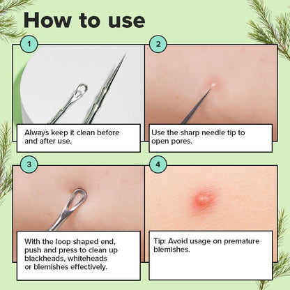 I DEW CARE Proper Popper Dual-Tip Pimple Tool – Stainless Steel Blackhead Remover & Blemish Extractor