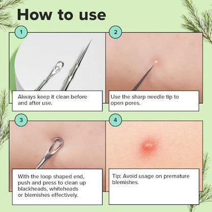 I DEW CARE Proper Popper Dual-Tip Pimple Tool – Stainless Steel Blackhead Remover & Blemish Extractor