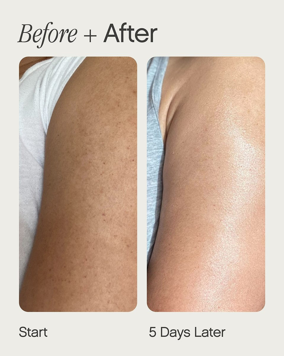 Topicals Slather Exfoliating Body Serum - With Retinol, Squalane, Urea and AHAs for Bumpy, Rough or Textured Skin - AHA Exfoliating Serum for Body (5 Fl Oz) Avelisse