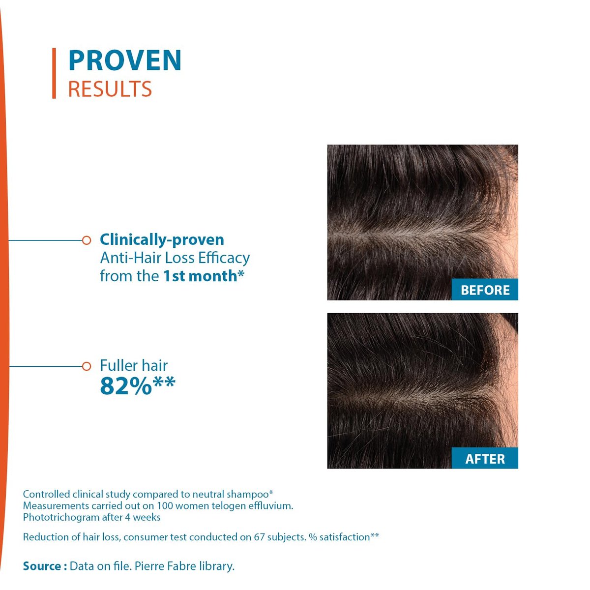 Ducray Creastim Reactiv Hair Loss Lotion – Intensive Regrowth Treatment for Thinning Hair, 60 ml Avelisse
