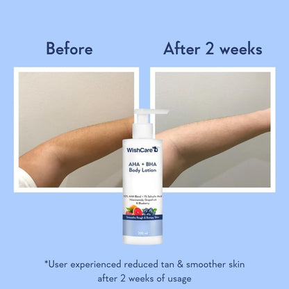 WishCare 10% AHA + 1% BHA Body Lotion for Men & Women - Exfoliating Body Lotion for Dry Skin, Detans, Smooths Rough & Bumpy Skin - 200ml