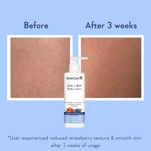 WishCare 10% AHA + 1% BHA Body Lotion for Men & Women - Exfoliating Body Lotion for Dry Skin, Detans, Smooths Rough & Bumpy Skin - 200ml - görsel 4