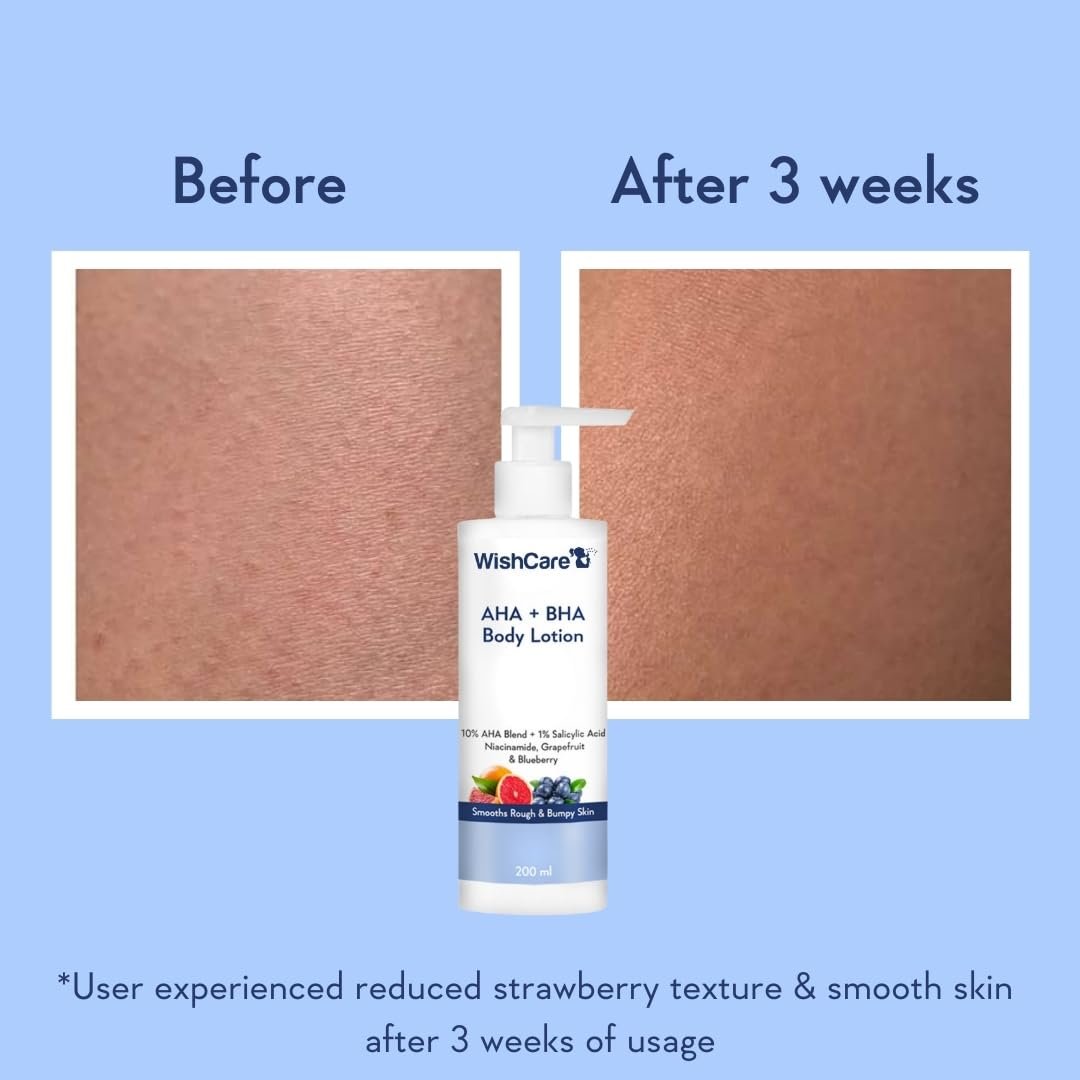 WishCare 10% AHA + 1% BHA Body Lotion for Men & Women - Exfoliating Body Lotion for Dry Skin, Detans, Smooths Rough & Bumpy Skin - 200ml - görsel 3