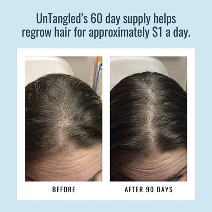 UnTangled Hair Vitamins - Collagen & Biotin Supplement for Thicker, Faster Hair Growth (60-Day Supply) Avelisse