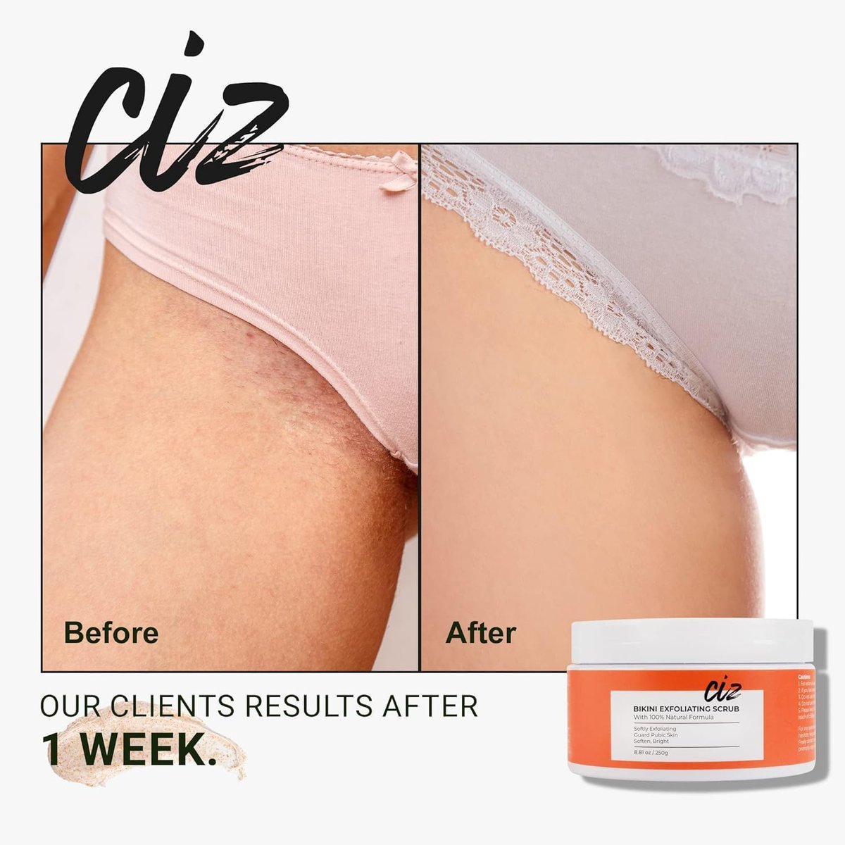 Bikini Area Exfoliator – Ingrown Hair & Razor Bump Treatment with Sugar Scrub for Women Avelisse