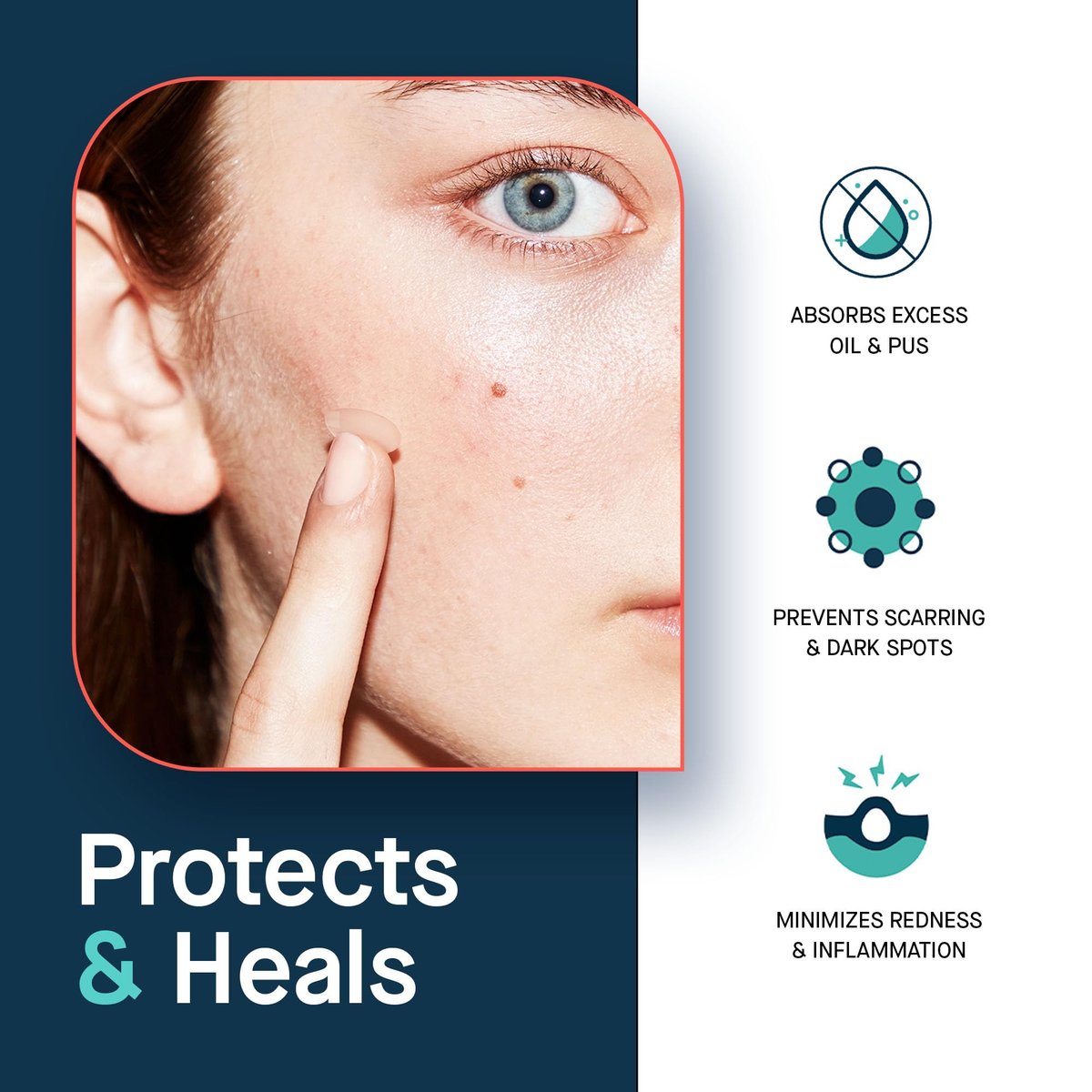 SLMD Salicylic Acid Pimple Patches – 24 Count, 2 Sizes – Treat Acne & Dark Spots by Dr. Pimple Popper Avelisse