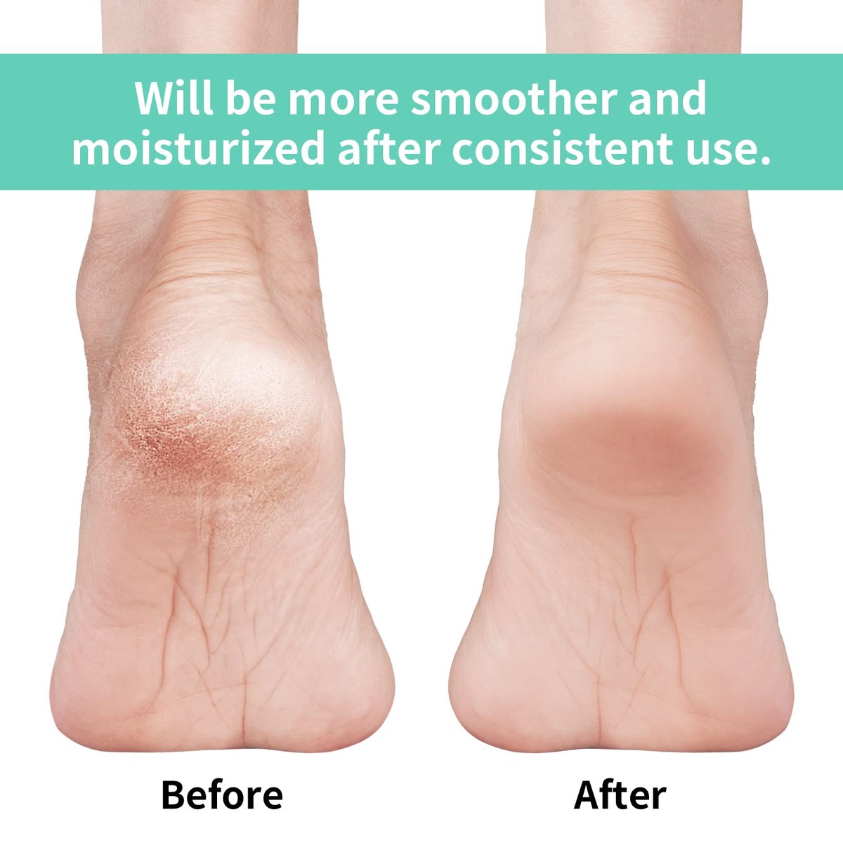 Vaincre Gel Moisturizing Heel Socks for Dry Cracked Feet Women, 4 Pairs - Overnight Cracked Heel Repair Treatment (Regular) - görsel 3