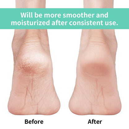 Vaincre Gel Moisturizing Heel Socks for Dry Cracked Feet Women, 4 Pairs - Overnight Cracked Heel Repair Treatment (Regular)