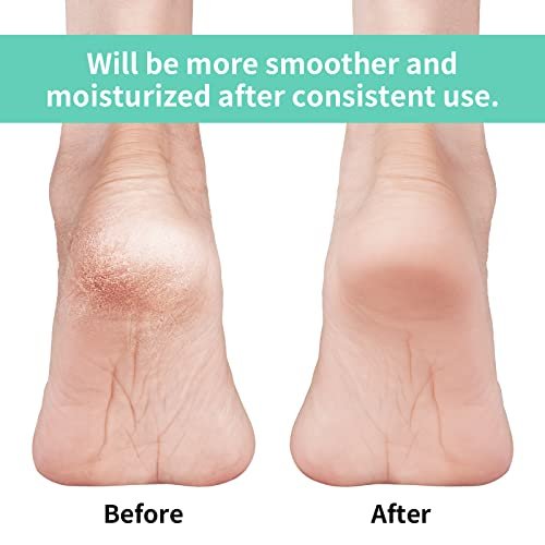 Vaincre Gel Moisturizing Heel Socks for Dry Cracked Feet Women, 4 Pairs - Overnight Cracked Heel Repair Treatment (Regular) - görsel 4