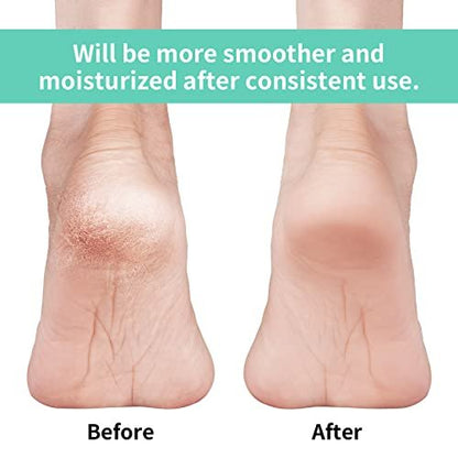 Vaincre Gel Moisturizing Heel Socks for Dry Cracked Feet Women, 4 Pairs - Overnight Cracked Heel Repair Treatment (Regular)