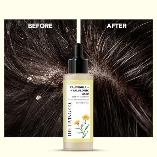 THE LIVING CO. Calendula + Hyaluronic Acid Soothing Scalp Serum - 65ml for Dandruff, Flaky & Dehydrated Scalp - görsel 4