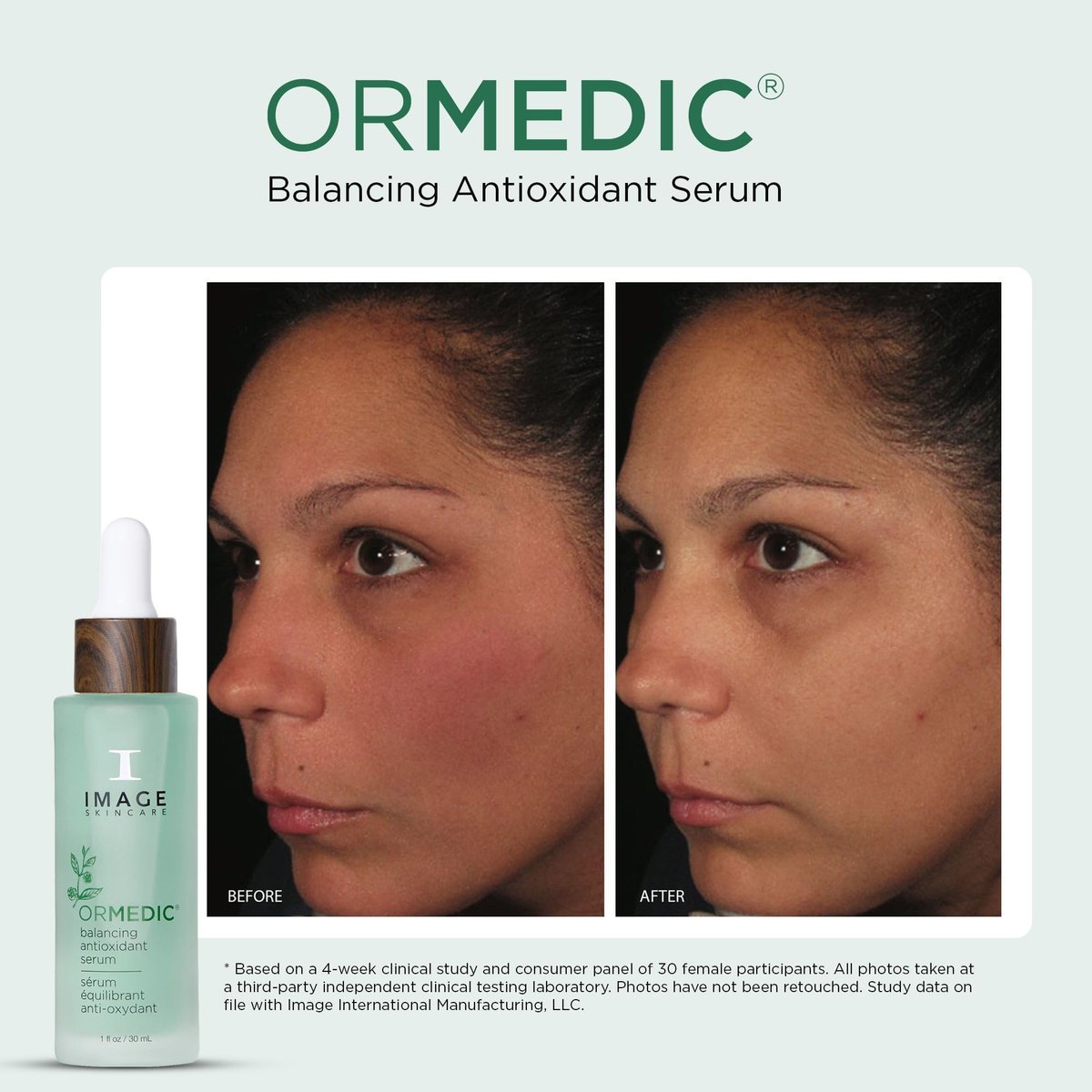 IMAGE Skincare ORMEDIC Balancing Antioxidant Serum – Hydrating & Soothing Face Serum with Organic Aloe Vera, Vitamin C & Botanical Extracts, 1 fl oz Avelisse