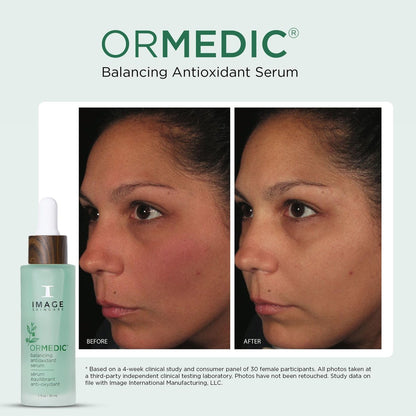 IMAGE Skincare ORMEDIC Balancing Antioxidant Serum – Hydrating & Soothing Face Serum with Organic Aloe Vera, Vitamin C & Botanical Extracts, 1 fl oz Avelisse