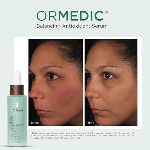 IMAGE Skincare ORMEDIC Balancing Antioxidant Serum – Hydrating & Soothing Face Serum with Organic Aloe Vera, Vitamin C & Botanical Extracts, 1 fl oz Avelisse