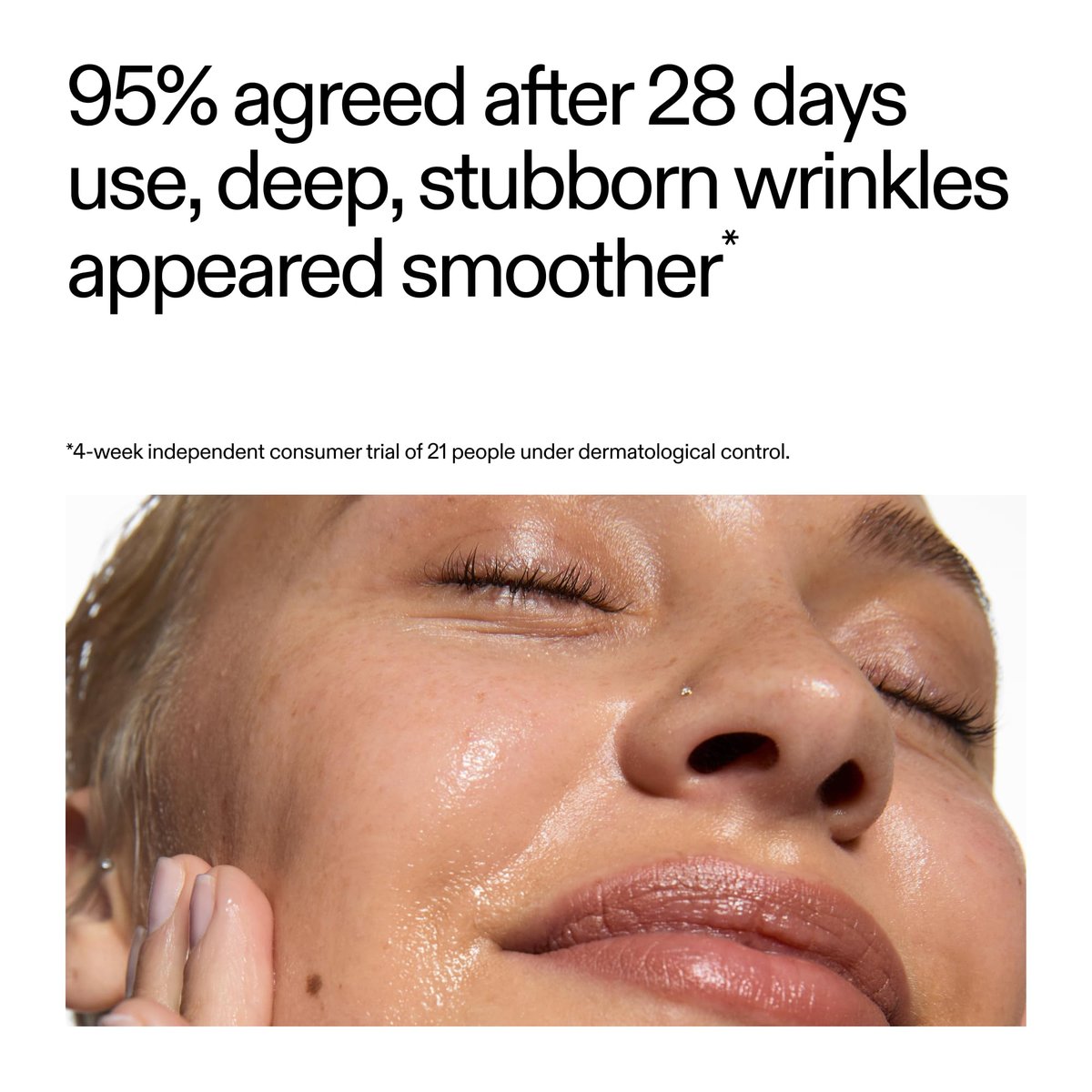 The INKEY List SuperSolutions 1% Retinol Serum – Face & Neck Treatment for Wrinkles, Scars & Skin Tone Avelisse