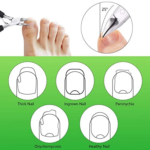 Feiccier Heavy Duty Ingrown Toenail Clippers – Professional Toenail Trimmer for Thick & Ingrown Nails, Sharp Curved Blade, Stainless Steel Pedicure Tool - görsel 10
