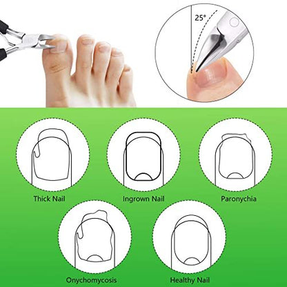 Feiccier Heavy Duty Ingrown Toenail Clippers – Professional Toenail Trimmer for Thick & Ingrown Nails, Sharp Curved Blade, Stainless Steel Pedicure Tool
