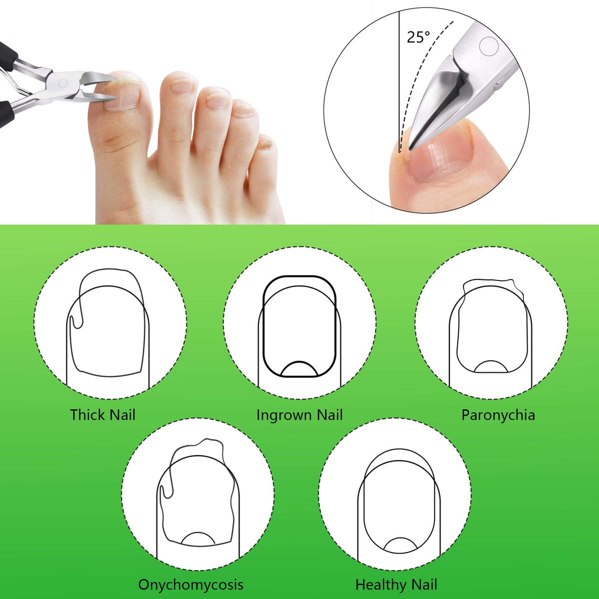 Feiccier Heavy Duty Ingrown Toenail Clippers – Professional Toenail Trimmer for Thick & Ingrown Nails, Sharp Curved Blade, Stainless Steel Pedicure Tool - görsel 9