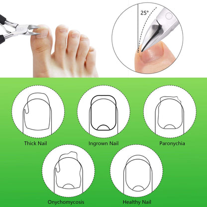 Feiccier Heavy Duty Ingrown Toenail Clippers – Professional Toenail Trimmer for Thick & Ingrown Nails, Sharp Curved Blade, Stainless Steel Pedicure Tool