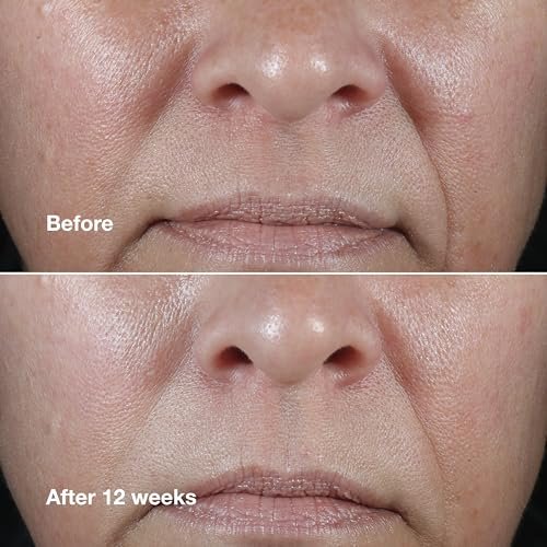 Clinique Smart Clinical Repair Wrinkle Correcting Anti Aging Rich Face Cream with Peptides + Hyaluronic Acid for Very Dry to Dry Combination Skin Types | Hydrating, 1.7 Fl Oz Avelisse