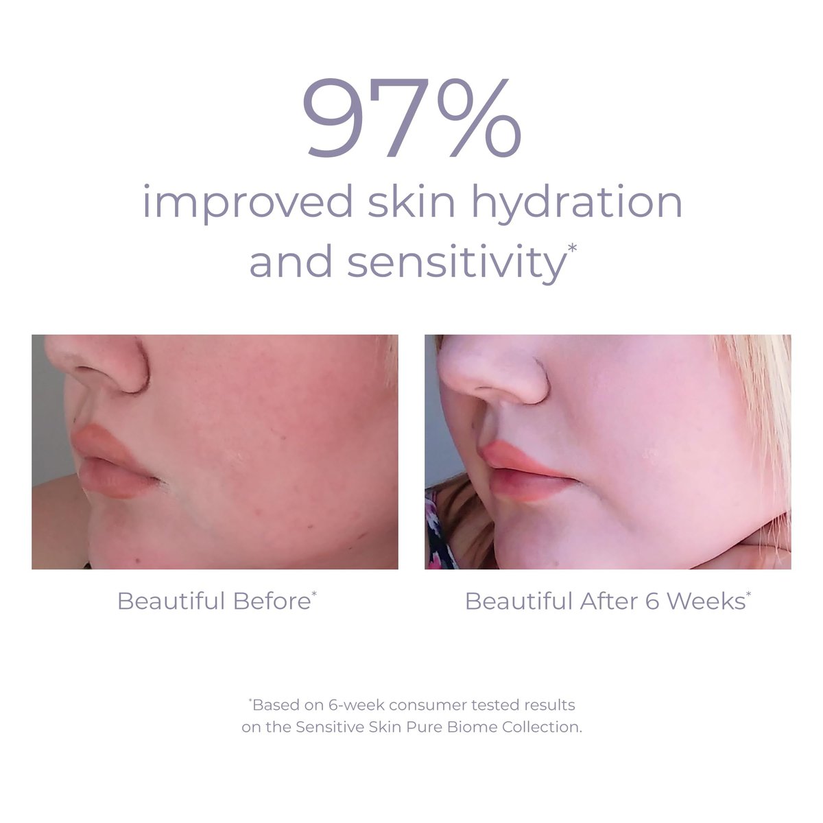 DERMA E Pure Biome Balancing Cream - 2 oz | Cranberry | Face Moisturizer for Balanced Skin Avelisse