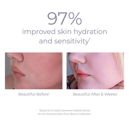 DERMA E Pure Biome Balancing Cream - 2 oz | Cranberry | Face Moisturizer for Balanced Skin Avelisse