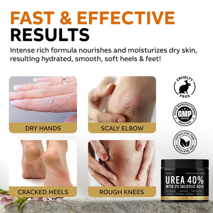 Adellina Urea Cream 40 Percent for Feet Maximum Strength - Dry Cracked Heels Repair Lotion 5.3 oz Avelisse