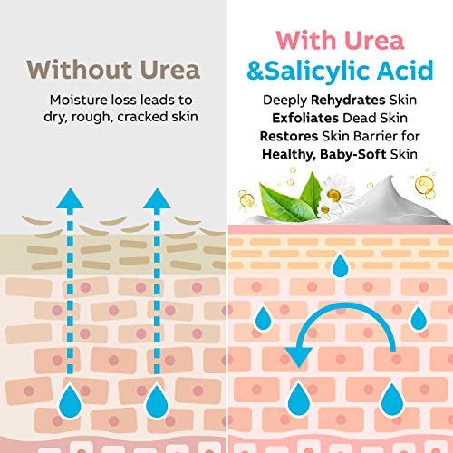 Adellina Urea Cream 40 Percent for Feet Maximum Strength - Dry Cracked Heels Repair Lotion 5.3 oz Avelisse