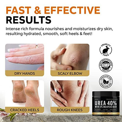 Adellina Urea Cream 40 Percent for Feet Maximum Strength - Dry Cracked Heels Repair Lotion 5.3 oz Avelisse
