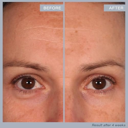 SKINN Multi-Acid Resurfacing Pads – Glycolic, Lactic & Salicylic Acid Exfoliating Treatment (60 Pads) Avelisse