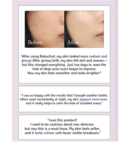 Korean Bakuchiol Concentrate 10000ppm - Retinol Alternative Serum, Vegan, Non-GMO, Cold Pressed, 30ml Avelisse